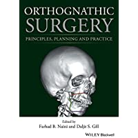 Orthognathic Surgery: Principles- Planning and Practice